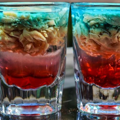 alien-brain-hemorrhage.html